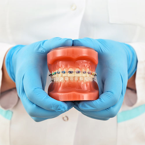 Mississauga orthodontist with mouth model
