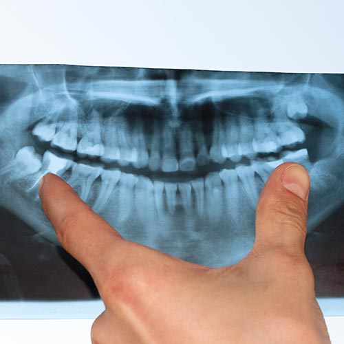 Dentist explaining panaromic x-ray result to patients